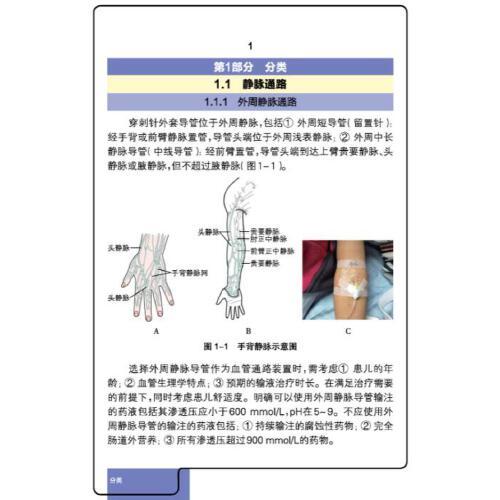 儿童血管通路管理