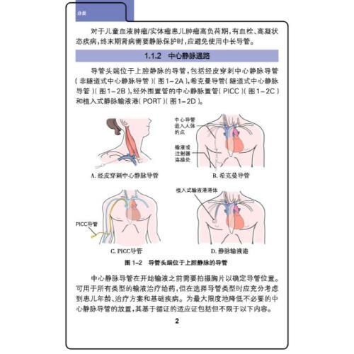 儿童血管通路管理