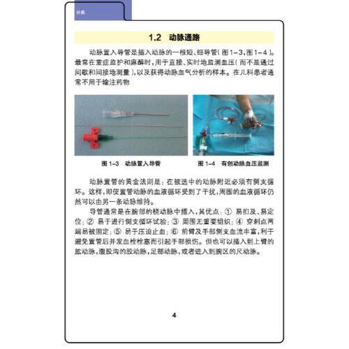 儿童血管通路管理