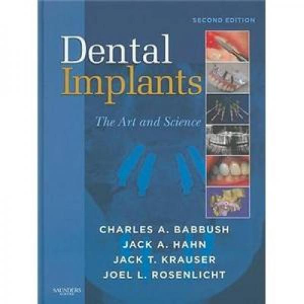 Dental Implants植牙:艺术与科学,第2版