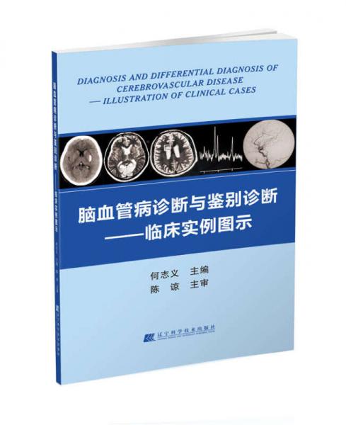 脑血管病诊断与鉴别诊断：临床实例图示