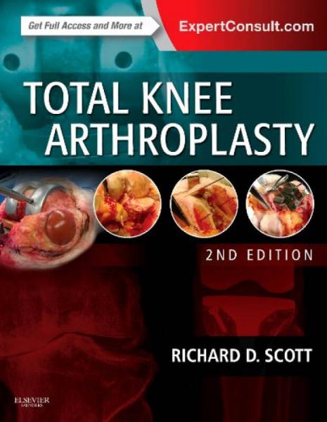 Total Knee Arthroplasty全膝关节成形术,第2版