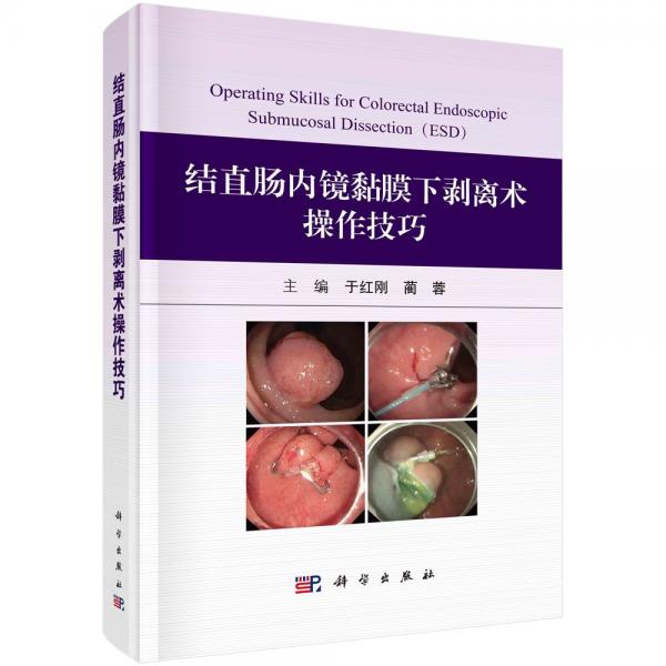 結(jié)直腸內(nèi)鏡黏膜下剝離術(shù)操作技巧
