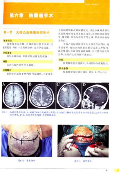 神经外科手术彩色图解/“十二五”国家图书出版规划项目·国家出版基金资助项目