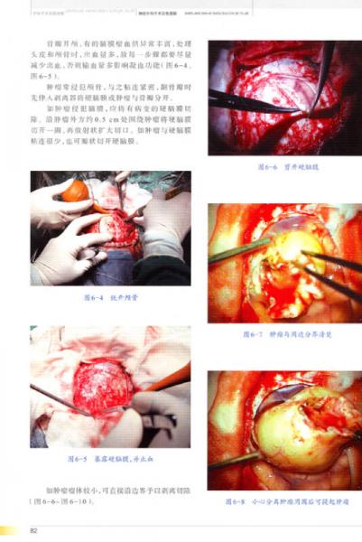 神经外科手术彩色图解/“十二五”国家图书出版规划项目·国家出版基金资助项目