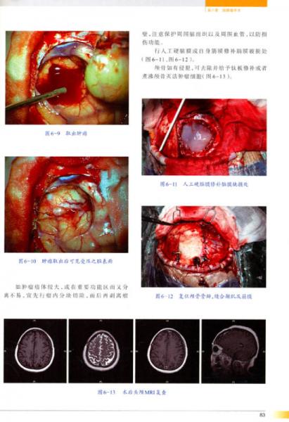 神经外科手术彩色图解/“十二五”国家图书出版规划项目·国家出版基金资助项目