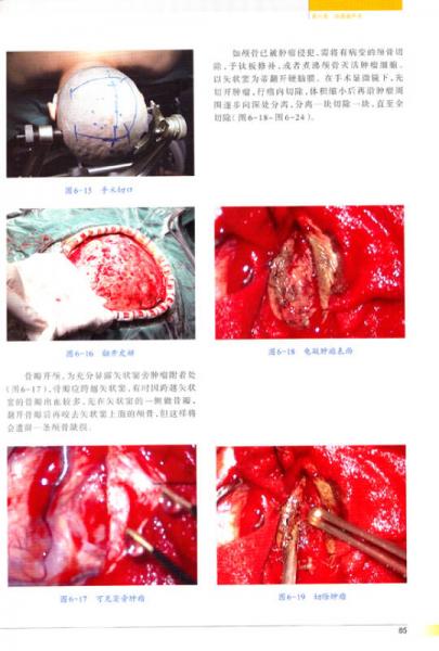 神经外科手术彩色图解/“十二五”国家图书出版规划项目·国家出版基金资助项目