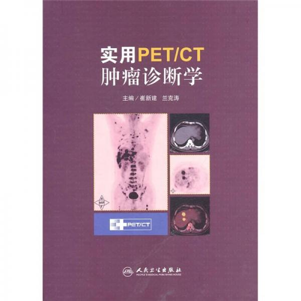 实用PET/CT肿瘤诊断学