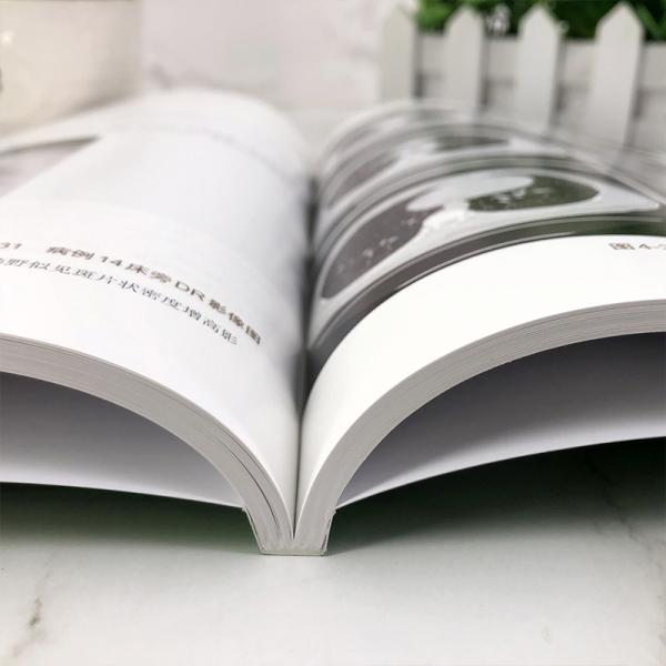 新型冠状病毒肺炎超声与CT对照图谱