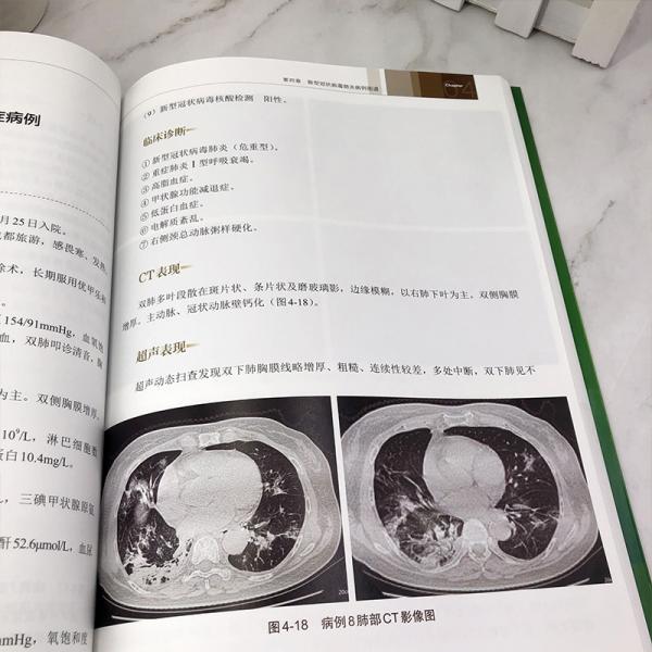 新型冠状病毒肺炎超声与CT对照图谱