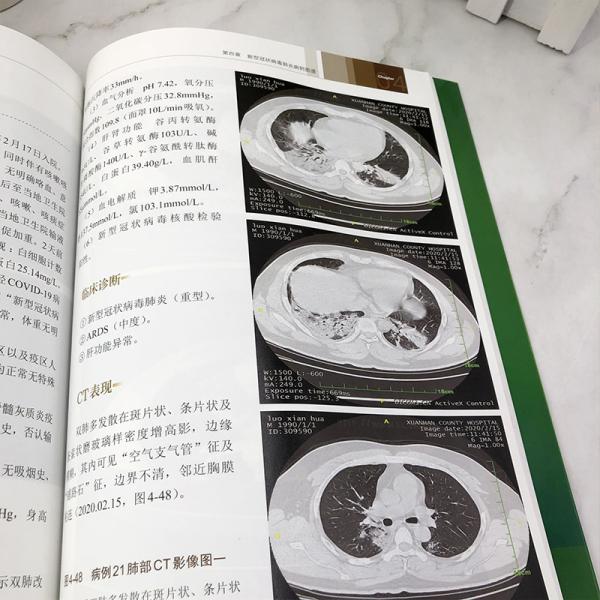 新型冠状病毒肺炎超声与CT对照图谱