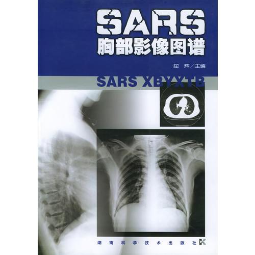 SARS胸部影像圖譜