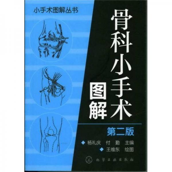 小手术图解丛书：骨科小手术图解（2版）