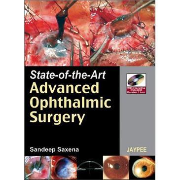 State-of-theArtAdvancedOphthalmicSurgery