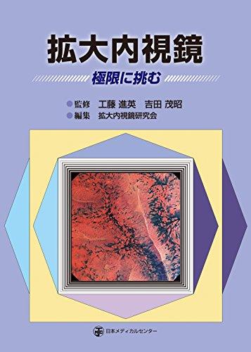 拡大內(nèi)視鏡 極限に挑む