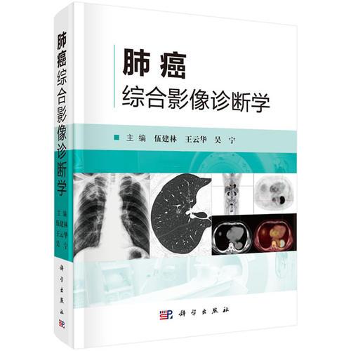 肺癌綜合影像診斷學(xué)