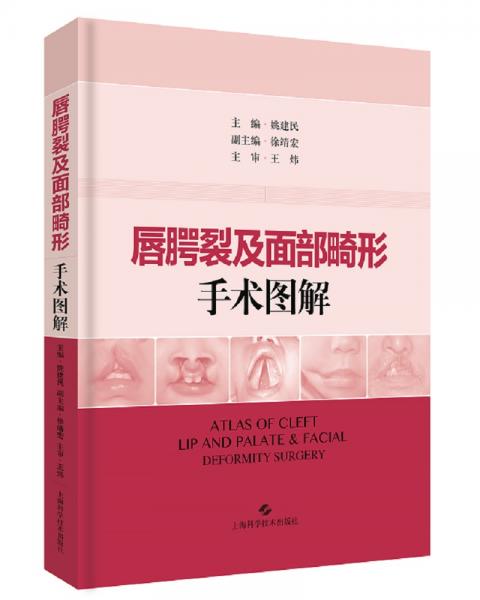 唇腭裂及面部畸形手術(shù)圖解