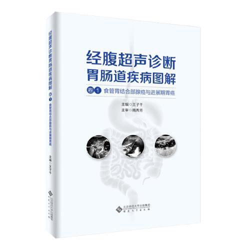 經(jīng)腹超聲診斷胃腸道疾病圖解（卷1 食管胃結(jié)合部腺癌與進(jìn)展期胃癌）