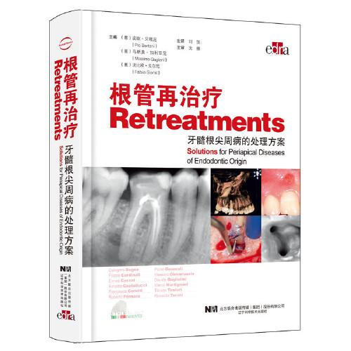 根管再治疗——牙髓根尖周病的处理方案