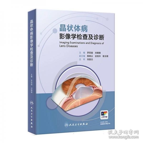 晶狀體病影像學(xué)檢查及診斷