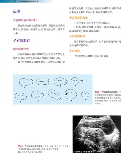 实用妇科疾患超声诊断