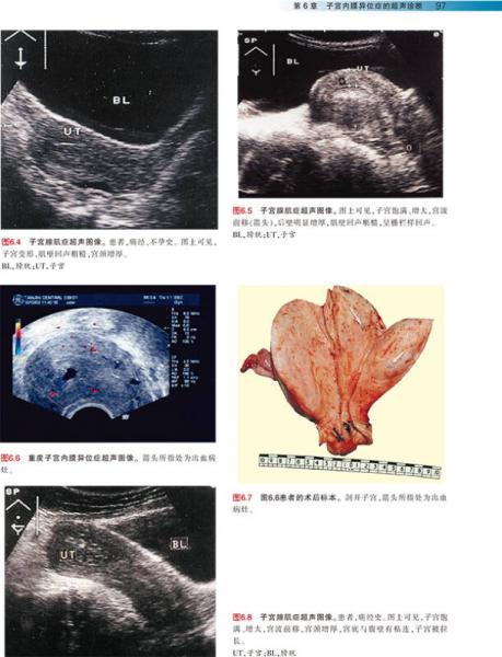 实用妇科疾患超声诊断