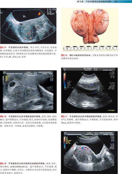 实用妇科疾患超声诊断