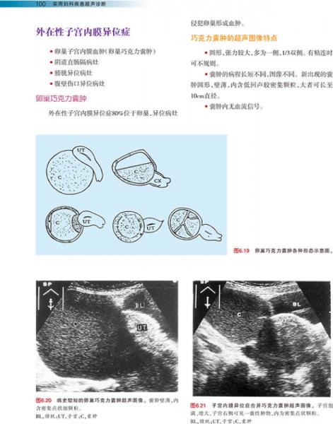 实用妇科疾患超声诊断