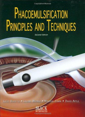 Phacoemulsification:PrinciplesandTechniques