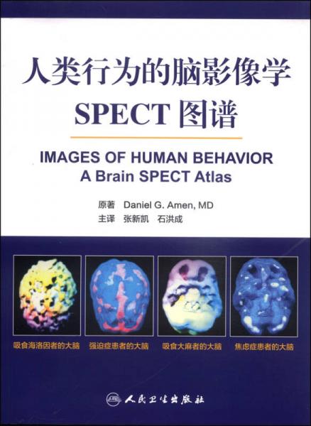 人類行為的腦影像學(xué)：SPECT圖譜
