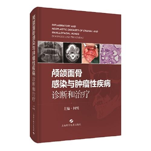 顱頜面骨感染與腫瘤性疾病:診斷和治療