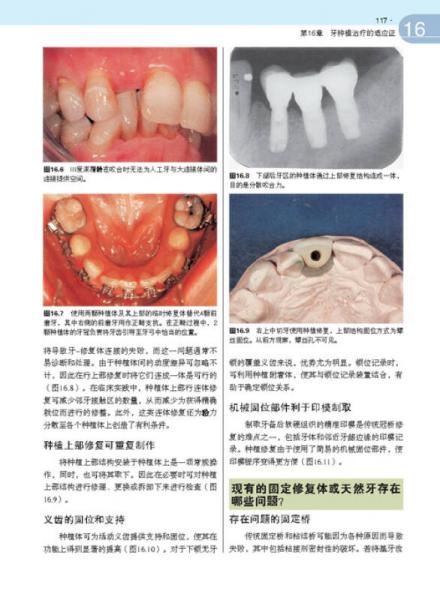 牙周与种植临床问题解决方案