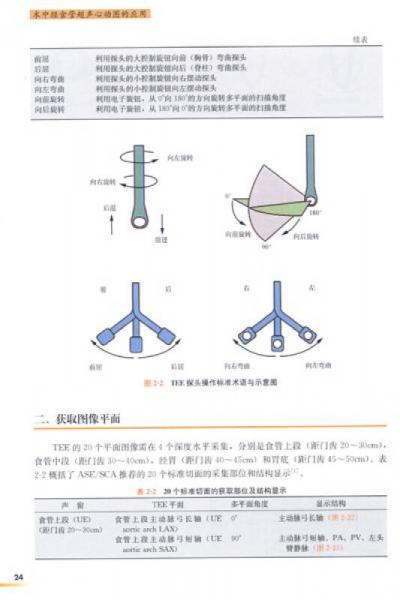高级麻醉医师系列丛书：术中经食管超声心动图的应用