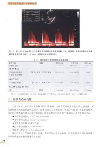 高级麻醉医师系列丛书：术中经食管超声心动图的应用