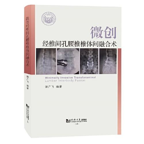 微創(chuàng)經(jīng)椎間孔腰椎椎體間融合術