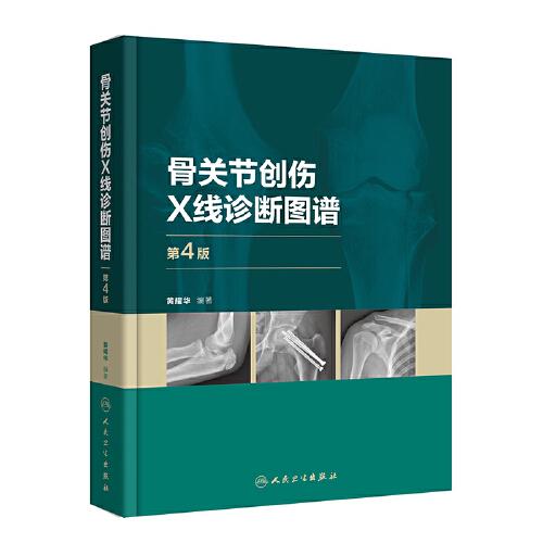 骨關節(jié)創(chuàng)傷X線診斷圖譜