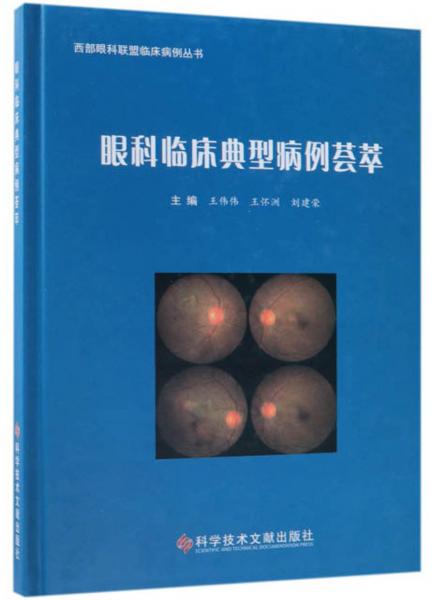眼科临床典型病例荟萃/西部眼科联盟临床病例丛书