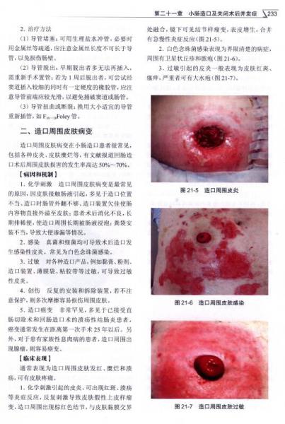 胃腸外科手術(shù)并發(fā)癥