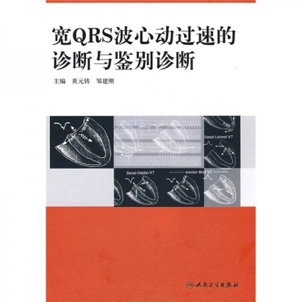 寬QRS波心動(dòng)過速的診斷與鑒別診斷