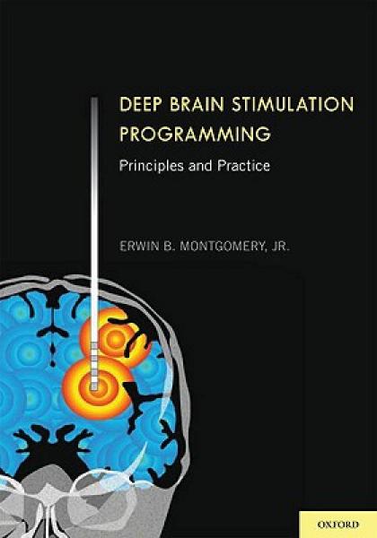 Deep Brain Stimulation Programming: Principles a
