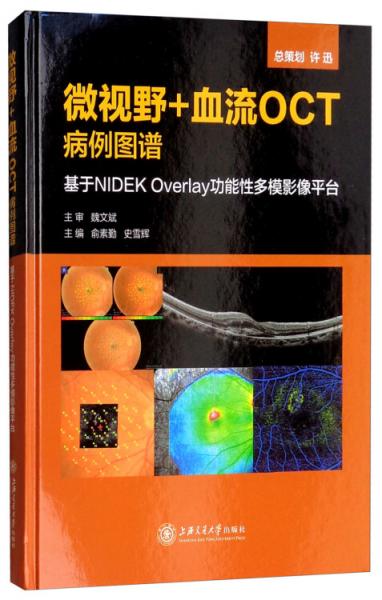 微視野+血流OCT病例圖譜：基于NIDEKOVERLAY功能性多模影像平臺(tái)