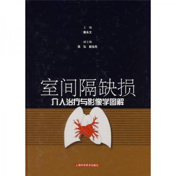 室間隔缺損介入治療與影像學(xué)圖解