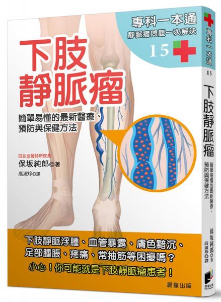 下肢靜脈瘤:簡單易懂的最新醫(yī)療、預(yù)防與保健方法