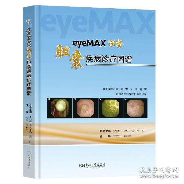 EYEMAX洞察 : 膽囊疾病診療圖譜