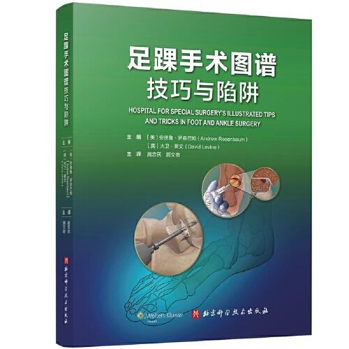 足踝手術(shù)圖譜：技巧與陷阱