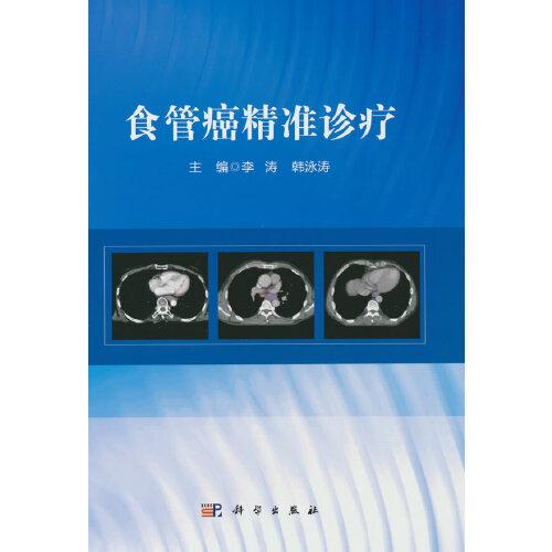 食管癌精準(zhǔn)診療