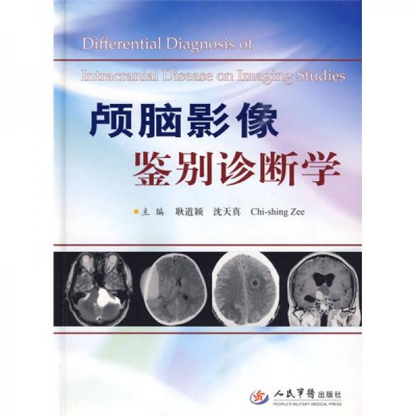 顱腦影像鑒別診斷學(xué)