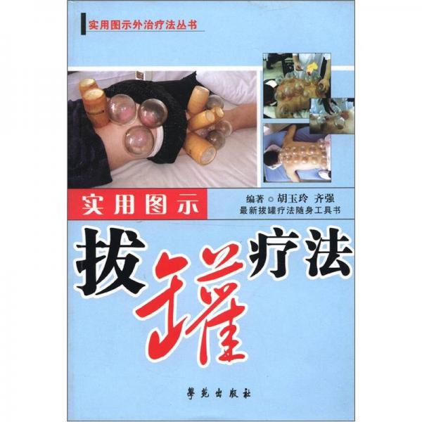 實用圖示外治療法叢書：實用圖示拔罐療法