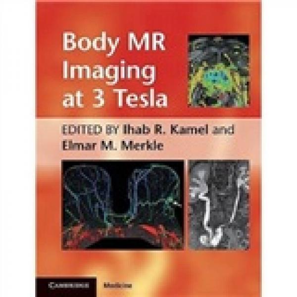 Body MR Imaging at 3 Tesla