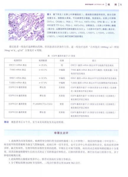 肺癌早期诊断与多学科治疗示例